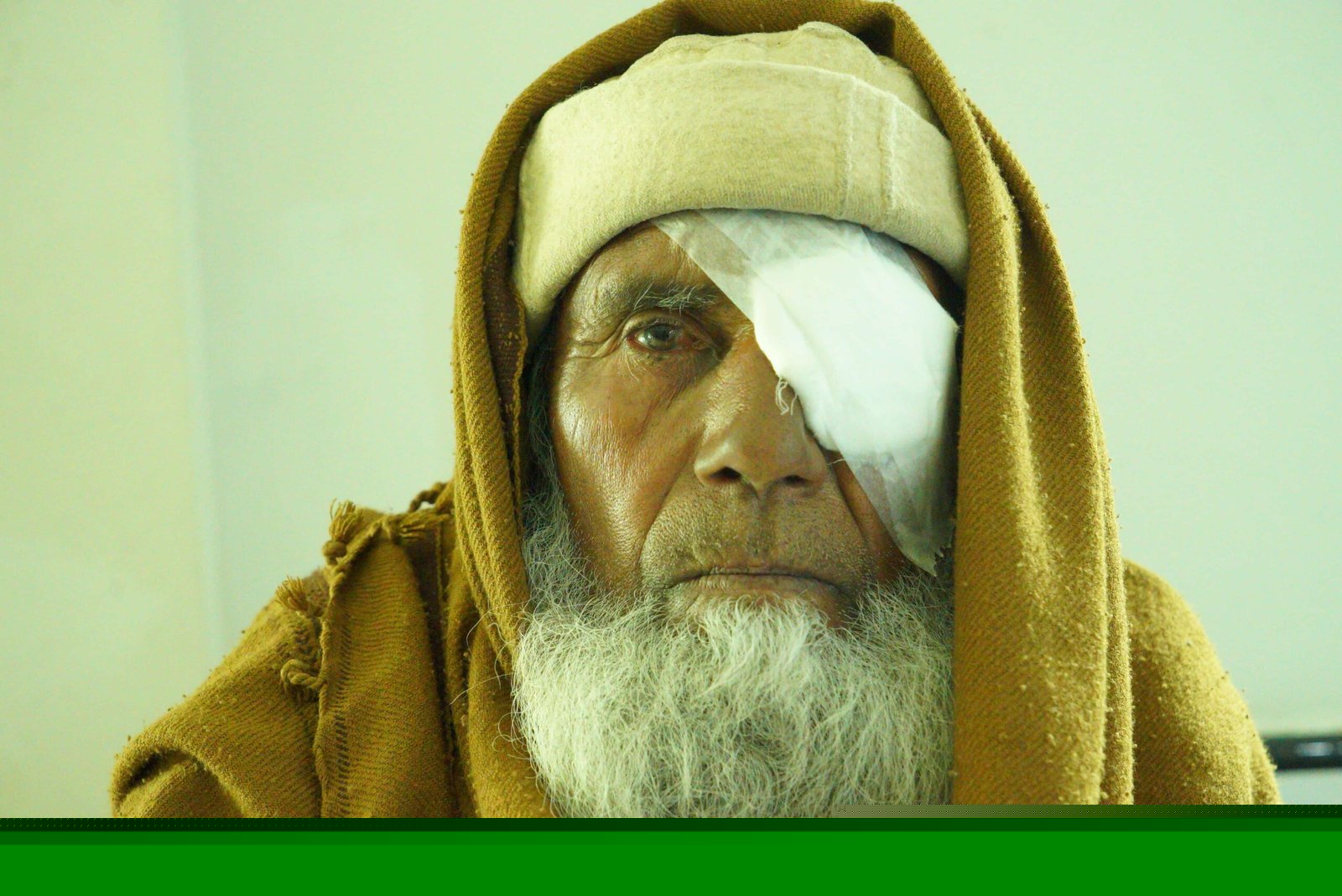 Elderly patient with eye bandage after successful cataract surgery